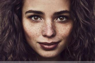 性功能障碍的症状图片